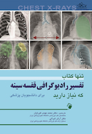 تنها کتاب تفسیر رادیوگرافی قفسه سینه که نیاز دارید